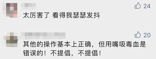 浙江男子被“超级毒蛇”咬了一口！一通神操作惊呆网友：这波自救太绝了