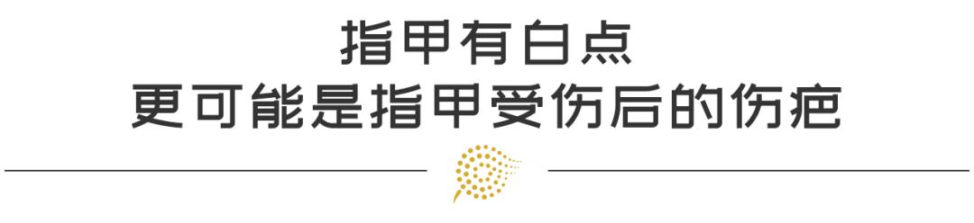 医学角度下的手相：手纹、指甲……暗示了什么？