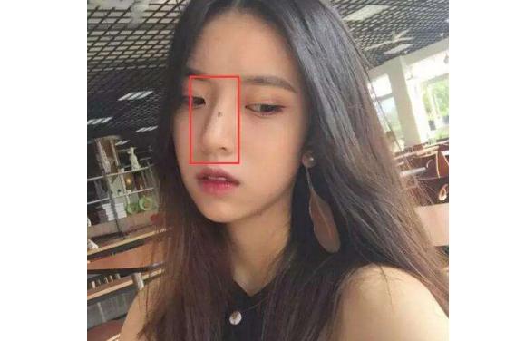 饭勺面相：眼皮上方有这个小黑点，30岁以后破财，尽量不要投资