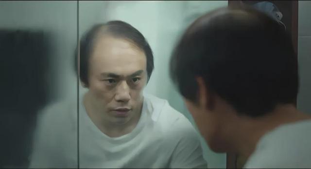 在脱发面前，明星不比普通人好到哪儿去
