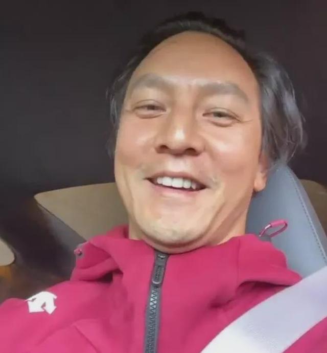 在脱发面前，明星不比普通人好到哪儿去