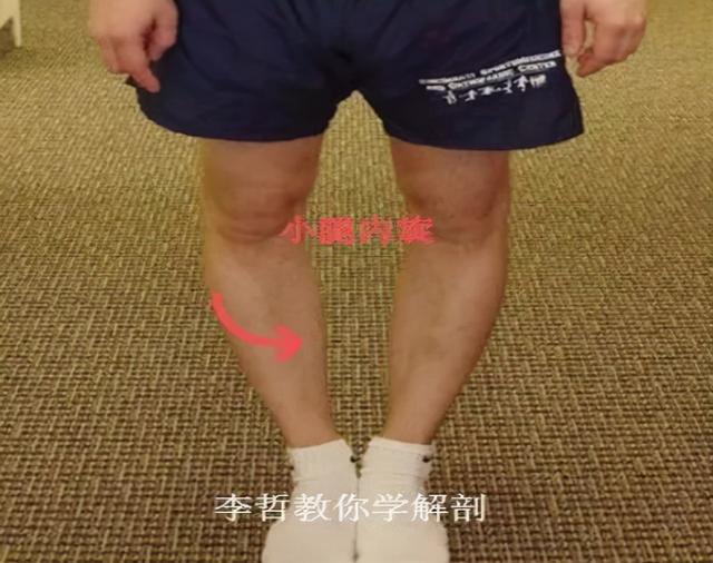 内生辰、外生辰孩子脚型正常不正常，家长可以这么判断