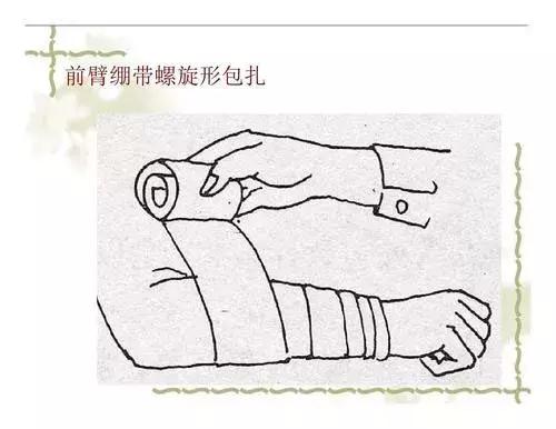 可以不会打领带！这4种急救包扎，一定要会!