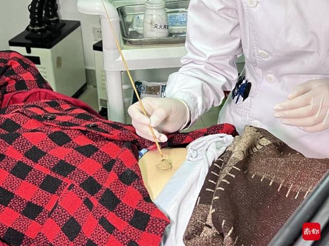 华南最大针灸医院今日揭牌，全院住院病人针灸率达94%