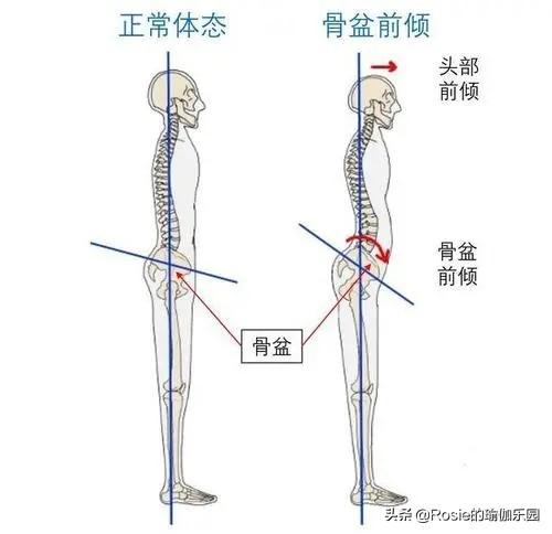 刘浩存美腿有瑕疵？如何改善假胯宽显腿长？每天睡前10min这样练