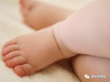宝宝学走路时为何会形成外生辰？怎样才能预防外生辰？