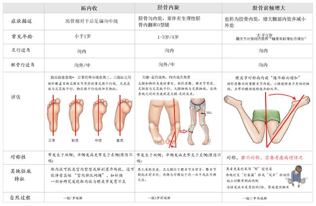 小孩走路内生辰，需要担心么？