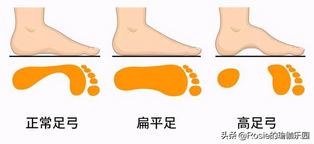 刘涛也内生辰？X型腿如何破？做好这2步细直疏影腿你也有