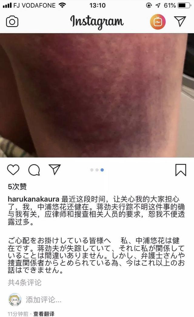 蒋劲夫也家暴男，女友网络晒受伤照片，网友：太残忍了！