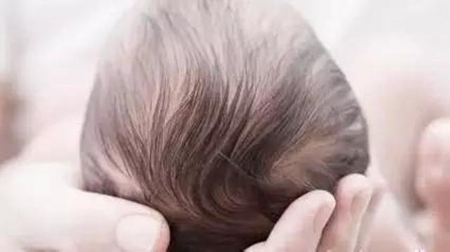 精选问答—宝宝骨关节有声响、枕骨骨折该怎么办？这样做才有效！