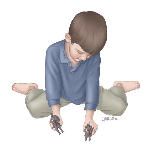 孩子走路内生辰外生辰，到底需不需要矫正，妈妈们看这一篇就够了