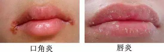 关晓彤这生辰真硬，被黑N年，这次终于怼回了？