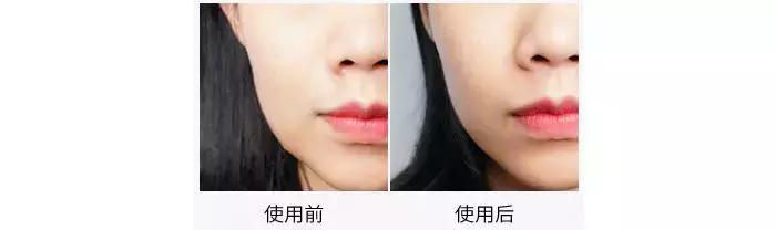 法令纹、双下巴、脸垮……想推荐郑爽和唐嫣用这件神器
