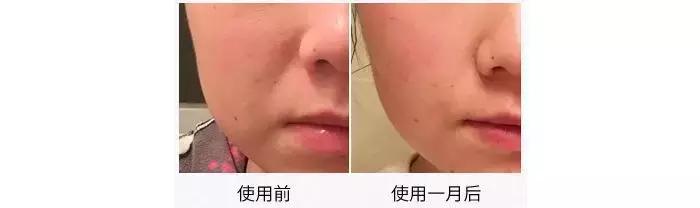 法令纹、双下巴、脸垮……想推荐郑爽和唐嫣用这件神器