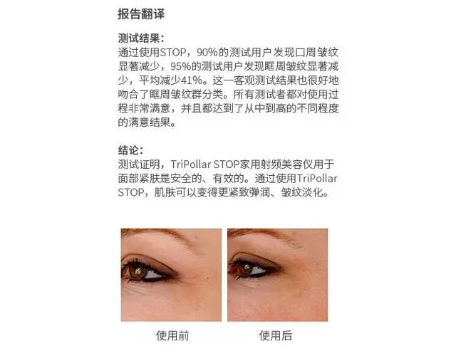 法令纹、双下巴、脸垮……想推荐郑爽和唐嫣用这件神器