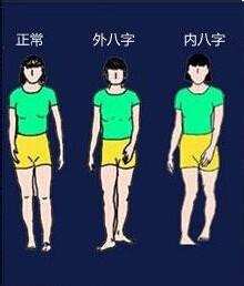 孩子走路生辰脚怎么办？这种方法最有效