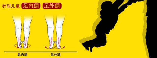 孩子走路生辰脚怎么办？这种方法最有效
