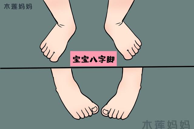 宝宝走路“生辰脚”，都是家长们这些行为导致的，快改掉这些做法