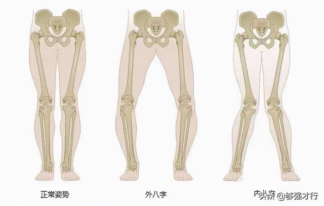 小日子过得不错的日本女孩为什么是“罗圈腿”、“内生辰”