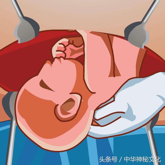 有观点认为，剖腹产出生的人，不能用生辰@￥！为什么？