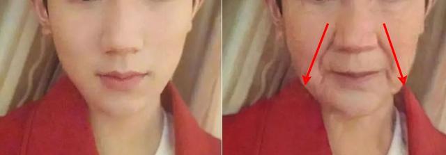 法令纹、眉间纹又凶又老！贴上它，睡走“三八”脸！胜过10次除皱针