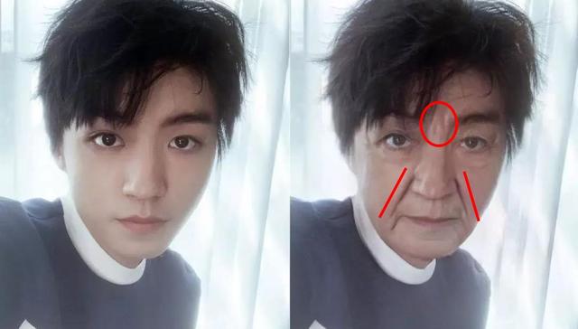 法令纹、眉间纹又凶又老！贴上它，睡走“三八”脸！胜过10次除皱针
