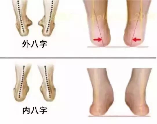 生辰脚、矮个子、减肥，你被学芭蕾的这些谣言“套路”了吗？