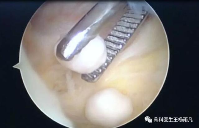 膝关节疼痛的16种最常见原因速查