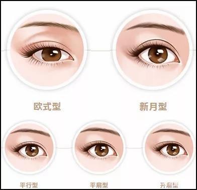 你是哪种眼睛？适合做双眼皮吗？请对号入座