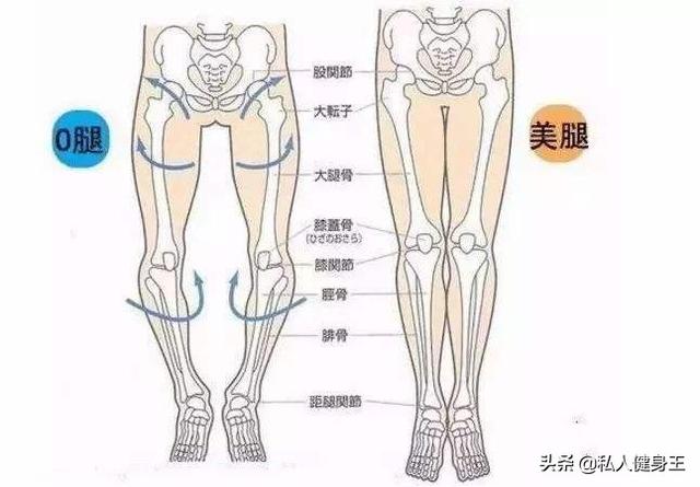 O型腿是如何形成的？有什么危害？如何改善O型腿，这套方法教你