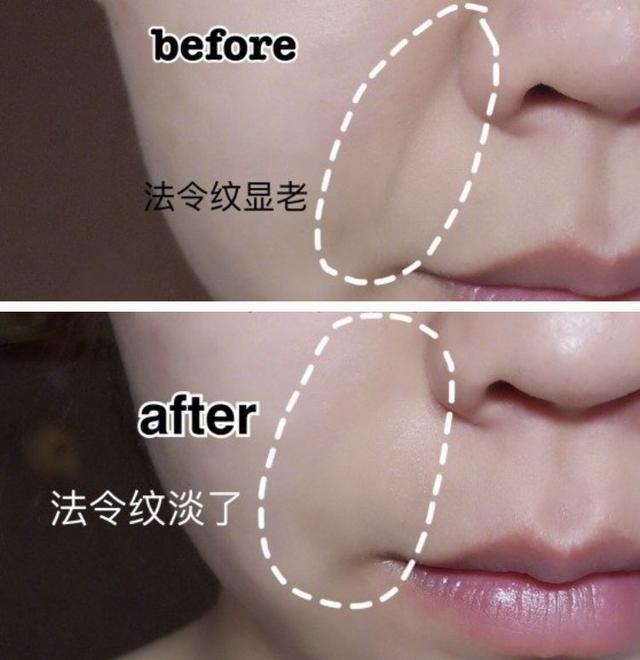 冻龄 | 法令纹、眉间纹又凶又老！贴上它，睡走“三八”脸
