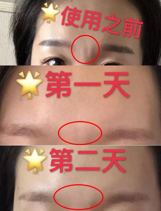 冻龄 | 法令纹、眉间纹又凶又老！贴上它，睡走“三八”脸