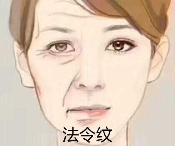 匠作美肤方案定制：笑纹和法令纹怎么区分？