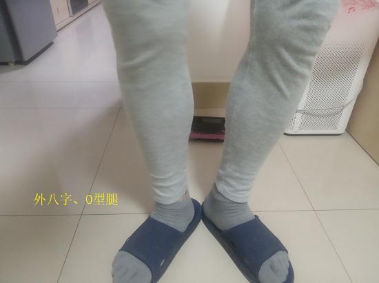 外生辰的纠正性训练