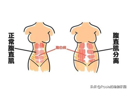 为什么做瑜伽体式头部后仰会恶心难受？为什么髋关节会响？