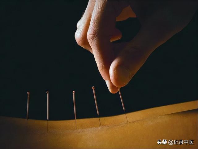 从时间针灸到时空针灸