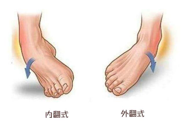 孩子第一次崴脚你重视了吗？护理不当，当心为习惯性崴脚埋下隐患