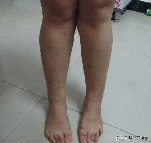宝宝腿部畸形，只因妈妈常做这个动作，这个错误很多父母没意识到