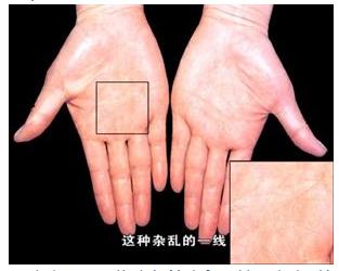 手的秘密——掌心的八卦图