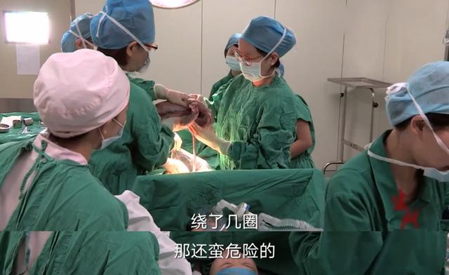 剖腹产定良辰，还具体到几点几分？早了10分钟，医生手术台上干等